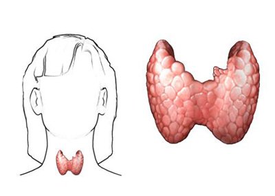 甲状腺,患者