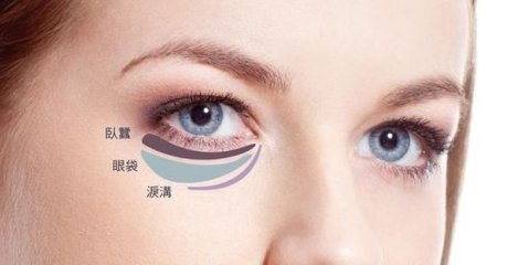 眼袋治疗,针灸治眼袋