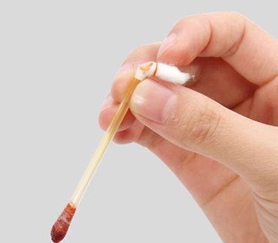 碘伏消毒,伤口消毒