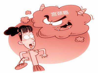 宫颈癌,女性宫颈癌