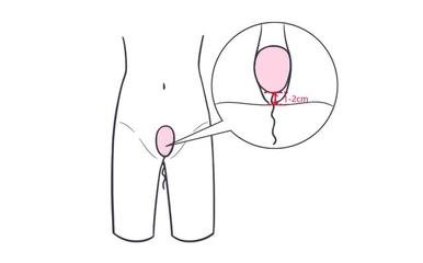 女性,疾病