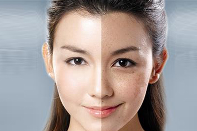 女性皮肤,调理皮肤
