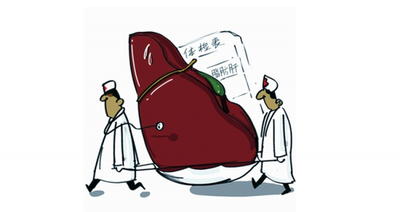脂肪肝,脂肪肝患者