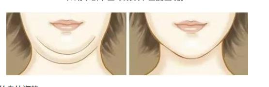 怎么瘦脸