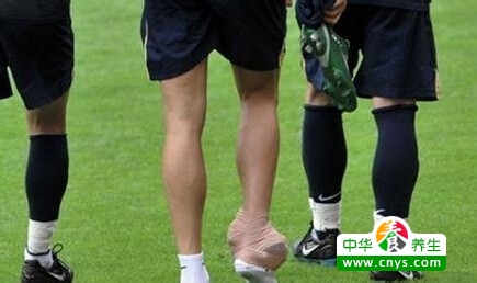 脚扭伤肿了该怎么办 怎样能退肿