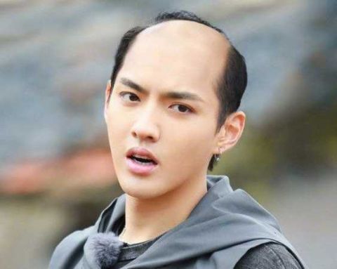 男性,秃头原因